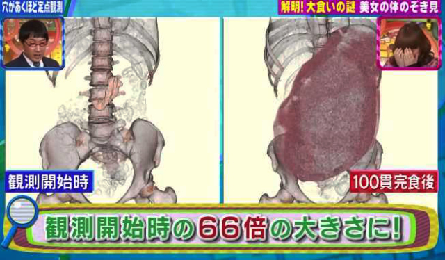 吃太撐可以讓胃變大4倍