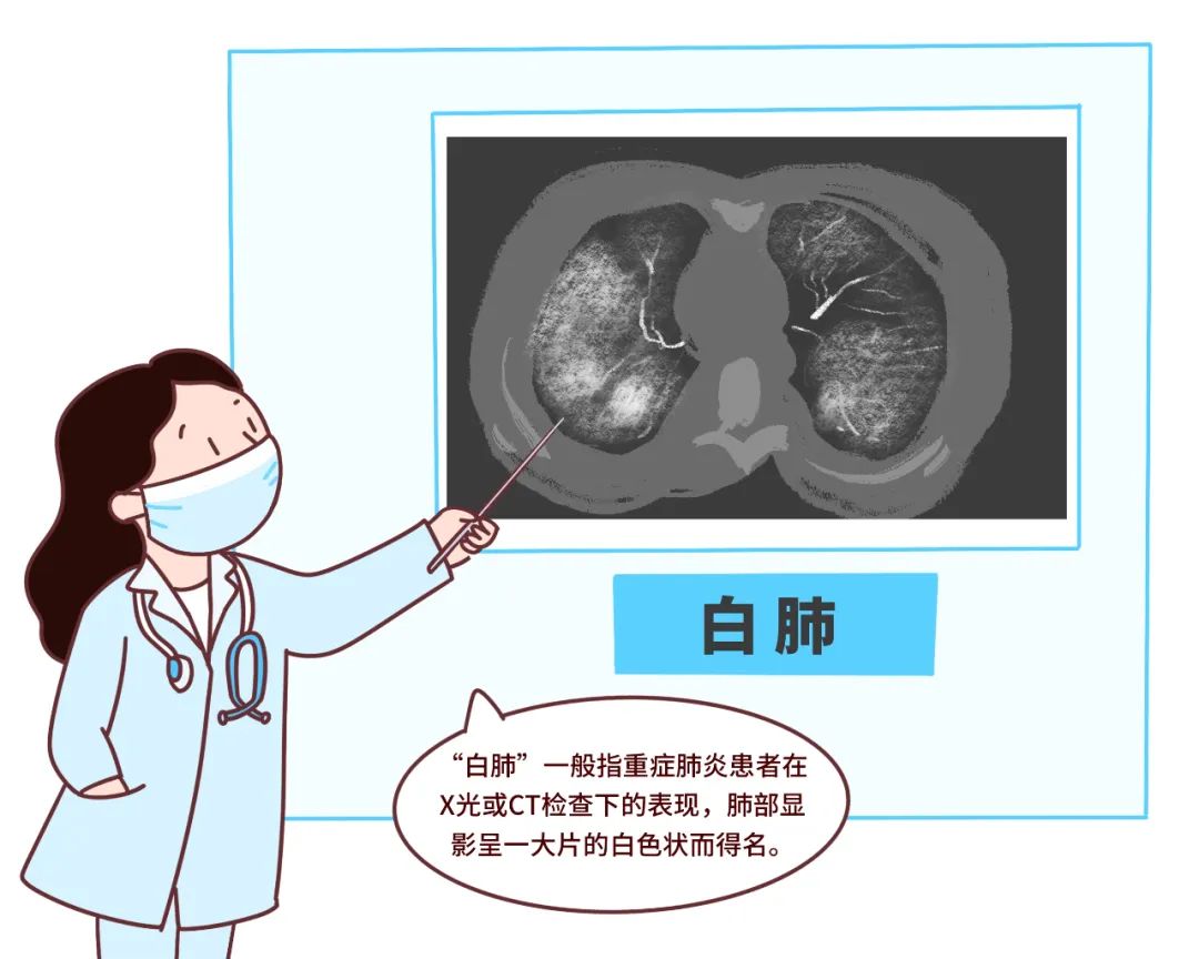 甲流偏愛肥胖病人合并可導致白肺