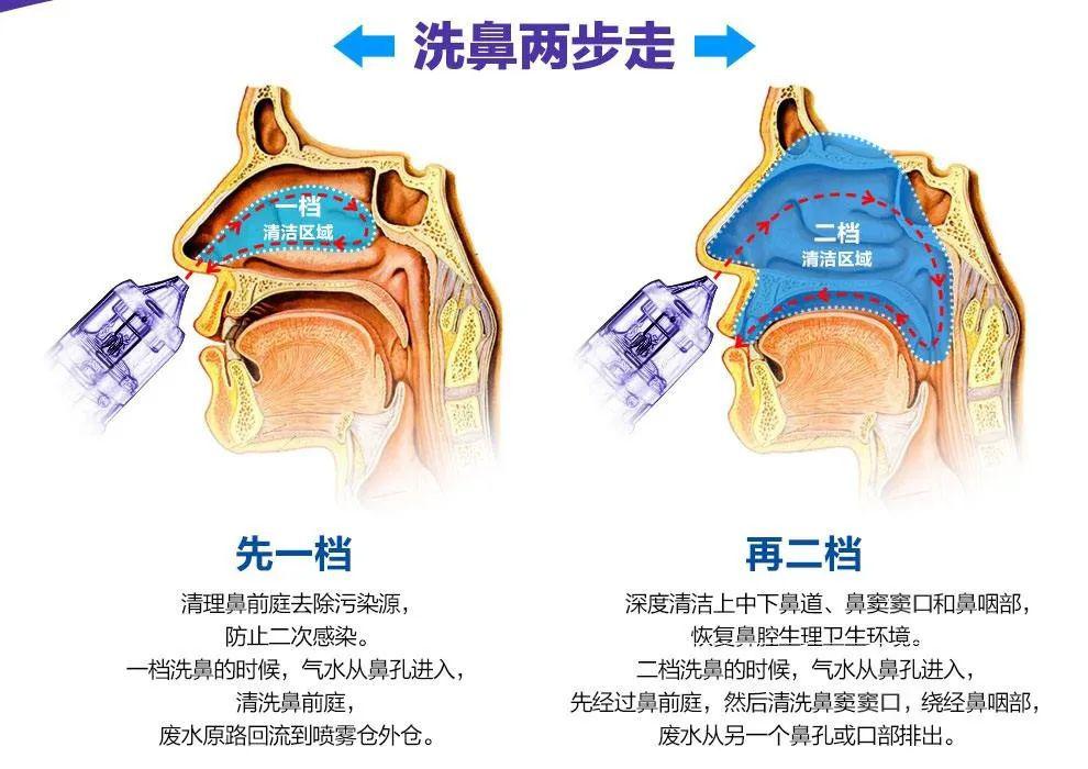 如何防治人偏肺病毒感染高發(fā)